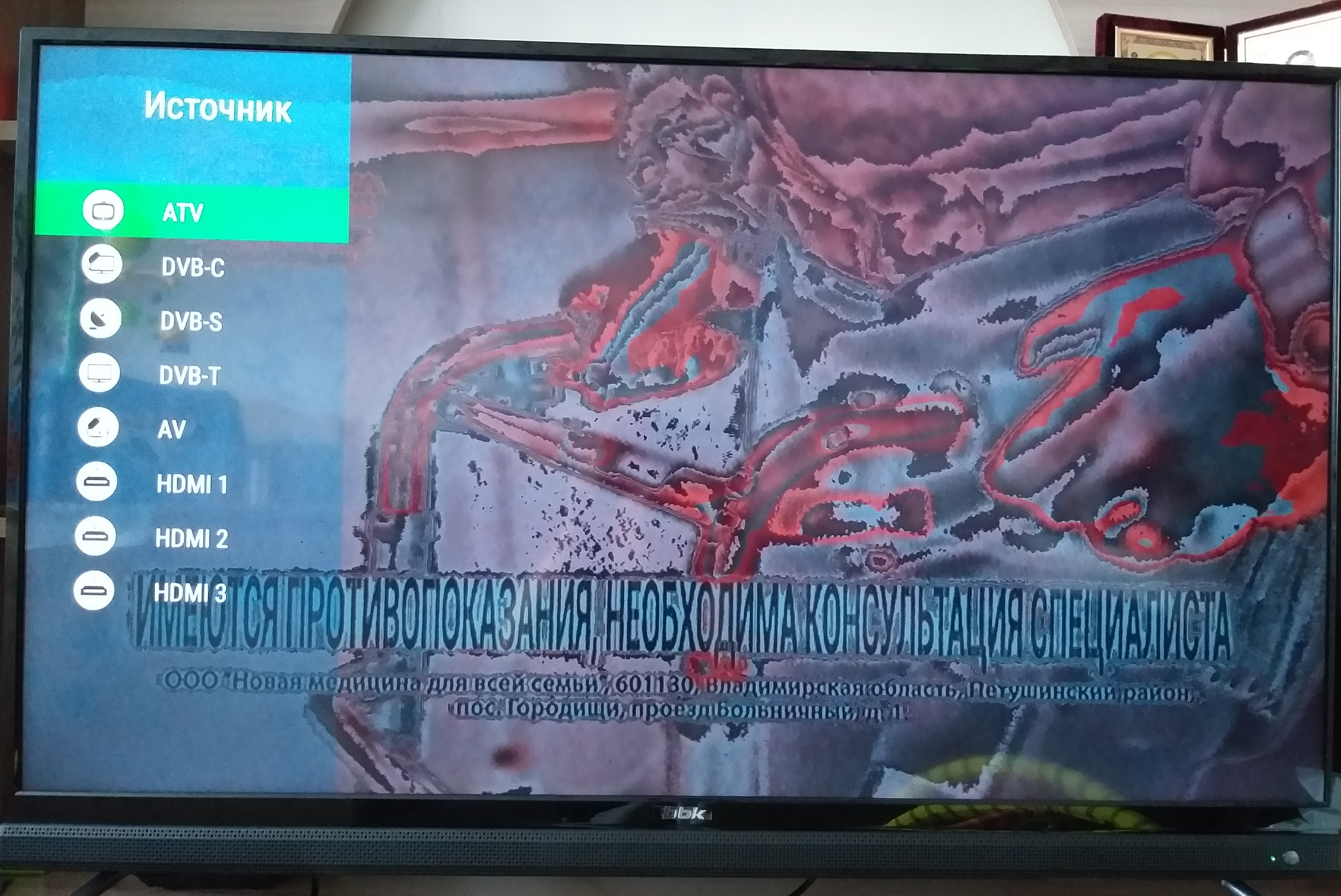 Экран в негативе