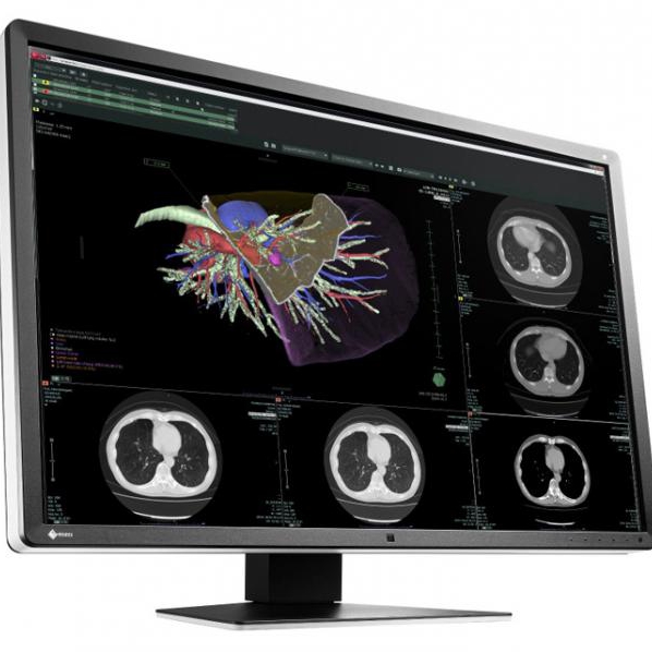 Компания ?EIZO показала...